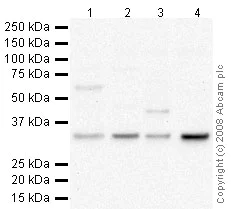 Western blot - Mouse pancreas tissue lysate - total protein (AB29363)