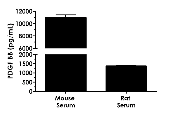 Sandwich ELISA - Mouse PDGF BB ELISA Kit (AB224879)