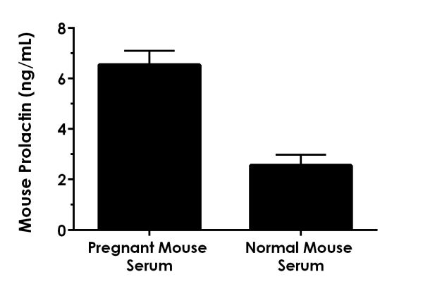 Sandwich ELISA - Mouse Prolactin/PRL ELISA Kit (AB214572)