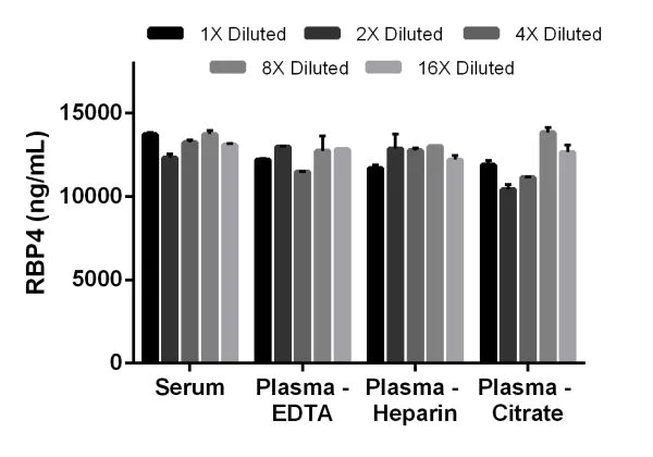 Sandwich ELISA - Mouse Retinol Binding Protein 4 ELISA Kit (AB202404)
