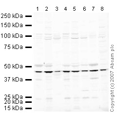 Western blot - Mouse skeletal muscle tissue lysate - total protein (AB29711), expandable thumbnail