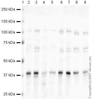 Western blot - Mouse skeletal muscle tissue lysate - total protein (ab29711), expandable thumbnail