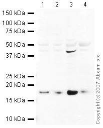 Western blot - Mouse skeletal muscle tissue lysate - total protein (AB29711)