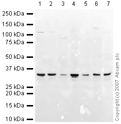 Western blot - Mouse skeletal muscle tissue lysate - total protein (AB29711)
