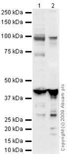 Western blot - Mouse skeletal muscle tissue lysate - total protein (ab29711), expandable thumbnail