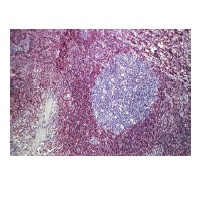 Immunohistochemistry (Formalin/PFA-fixed paraffin-embedded sections) - Mouse Specific HRP/AEC Detection IHC kit (AB64258), expandable thumbnail