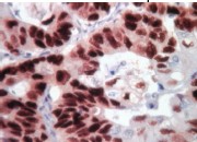 Immunohistochemistry (Formalin/PFA-fixed paraffin-embedded sections) - Mouse specific HRP/DAB Detection IHC Kit (AB64259), expandable thumbnail