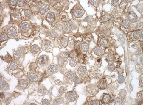 Immunohistochemistry (Frozen sections) - Anti-Mov10 antibody [15C1B8] (AB176687)