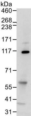 Immunoprecipitation - Anti-Mov10 antibody [15C1B8] (AB176687)