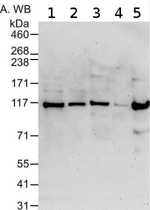 Western blot - Anti-Mov10 antibody [15C1B8] (AB176687)