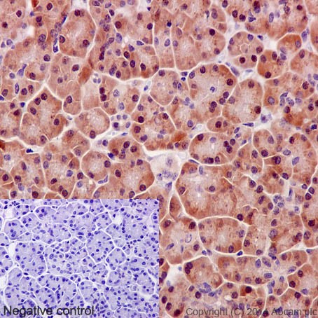 Immunohistochemistry (Formalin/PFA-fixed paraffin-embedded sections) - Anti-Mov10 antibody [EPR14478] (AB189919)