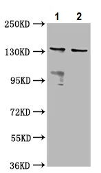 Western blot - Anti-MOV10L1/Champ antibody (AB236977)