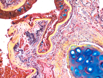 Immunohistochemistry (Formalin/PFA-fixed paraffin-embedded sections) - Movat Pentachrome Stain Kit (Modified Russell-Movat) (AB245884)