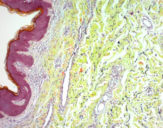Immunohistochemistry (Formalin/PFA-fixed paraffin-embedded sections) - Movat Pentachrome Stain Kit (Modified Russell-Movat) (AB245884)
