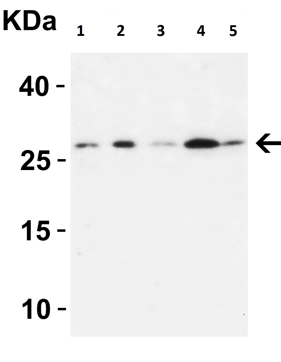Western blot - Anti-MOX1/MEOX1 antibody (AB105349), expandable thumbnail