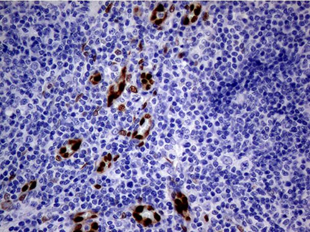 Immunohistochemistry (Formalin/PFA-fixed paraffin-embedded sections) - Anti-MOX1/MEOX1 antibody [OTI5D8] (AB279366)