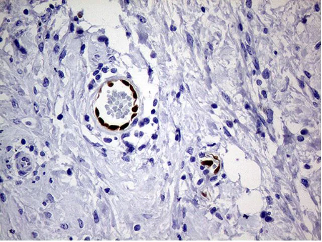 Immunohistochemistry (Formalin/PFA-fixed paraffin-embedded sections) - Anti-MOX1/MEOX1 antibody [OTI5D8] (AB279366)