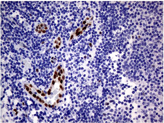 Immunohistochemistry (Formalin/PFA-fixed paraffin-embedded sections) - Anti-MOX1/MEOX1 antibody [OTI5D8] (AB279366)