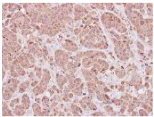 Immunohistochemistry (Formalin/PFA-fixed paraffin-embedded sections) - Anti-MOXD1/MOX antibody (AB153807)