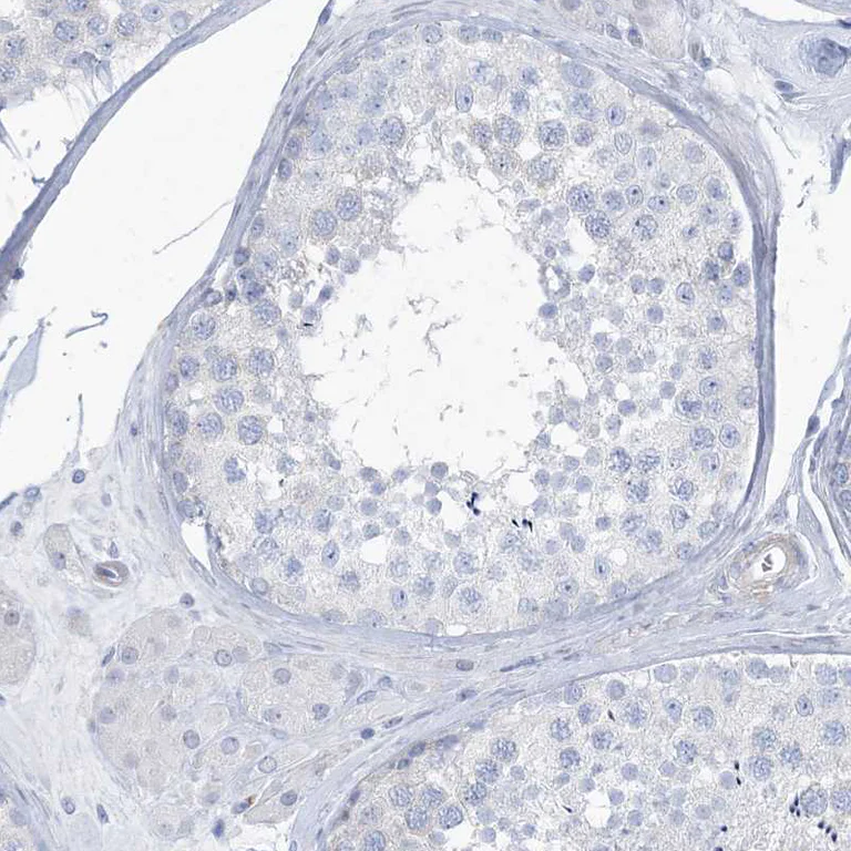 Immunohistochemistry (Formalin/PFA-fixed paraffin-embedded sections) - Anti-MOXD1/MOX antibody (AB251840)