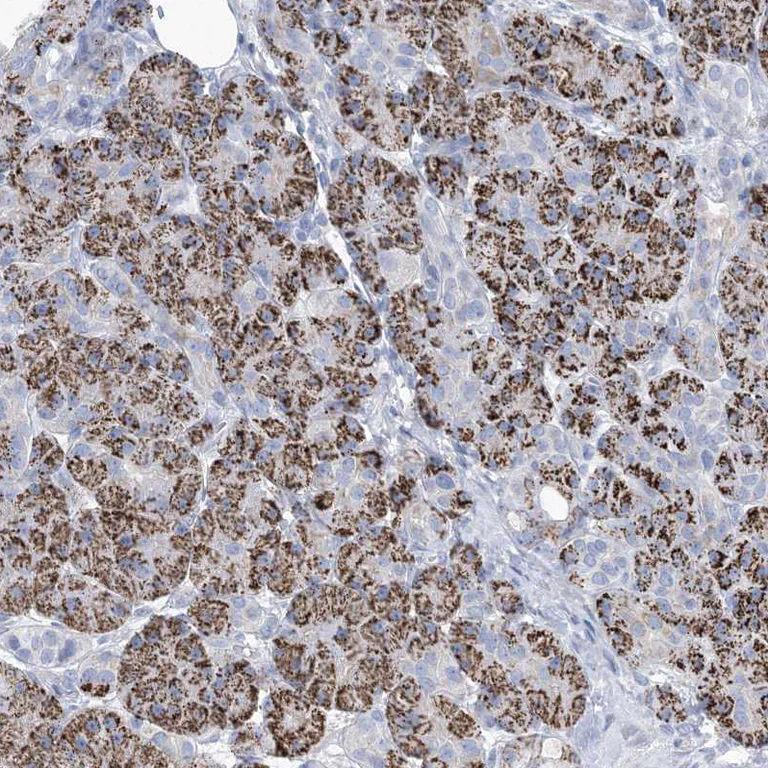 Immunohistochemistry (Formalin/PFA-fixed paraffin-embedded sections) - Anti-MOXD1/MOX antibody (AB251840)