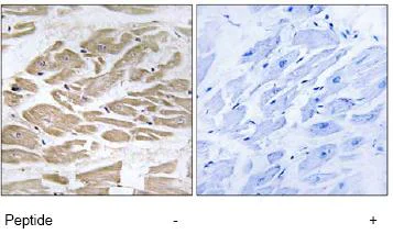 Immunohistochemistry (Formalin/PFA-fixed paraffin-embedded sections) - Anti-MPC1 antibody (AB74871)