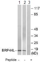 Western blot - Anti-MPC1 antibody (AB74871)