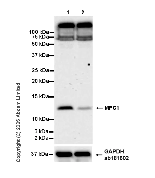 Western blot - Anti-MPC1 antibody [EPR29172-82] (AB324682)