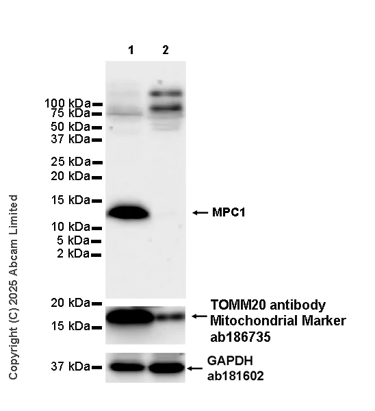 Western blot - Anti-MPC1 antibody [EPR29172-82] (AB324682)