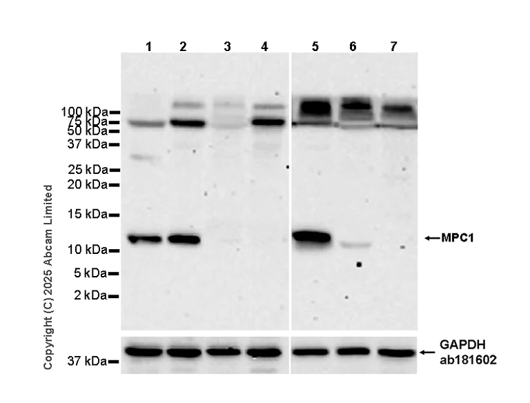 Western blot - Anti-MPC1 antibody [EPR29172-82] (AB324682)