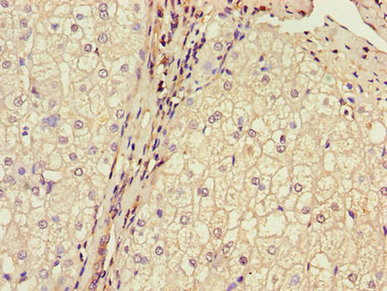 Immunohistochemistry (Formalin/PFA-fixed paraffin-embedded sections) - Anti-MPC2 antibody (AB236584)