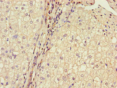Immunohistochemistry (Formalin/PFA-fixed paraffin-embedded sections) - Anti-MPC2 antibody (AB236584)