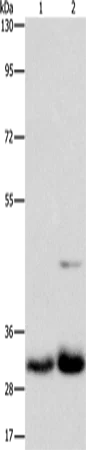 Western blot - Anti-MPG/AAG antibody (AB196553)