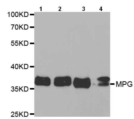Western blot - Anti-MPG/AAG antibody (AB196553)