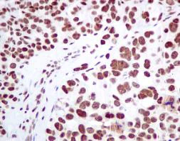 Immunohistochemistry (Formalin/PFA-fixed paraffin-embedded sections) - Anti-MPG/AAG antibody [EPR10959(B)] - BSA and Azide free (AB249186)
