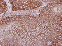 Immunohistochemistry (Formalin/PFA-fixed paraffin-embedded sections) - Anti-MPP1 antibody (AB96255)