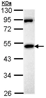 Western blot - Anti-MPP1 antibody (AB96255)
