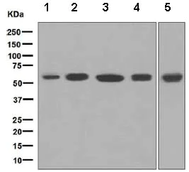 Western blot - Anti-MPP1 antibody [EPR5864] (AB133500)