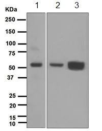 Western blot - Anti-MPP1 antibody [EPR5865] (AB108528)
