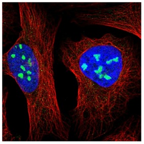 Immunocytochemistry - Anti-MPP10 antibody (AB204328), expandable thumbnail