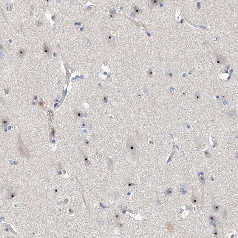 Immunohistochemistry (Formalin/PFA-fixed paraffin-embedded sections) - Anti-MPP10 antibody (AB204328), expandable thumbnail