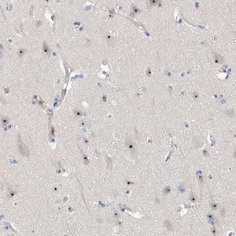 Immunohistochemistry (Formalin/PFA-fixed paraffin-embedded sections) - Anti-MPP10 antibody (AB204328)