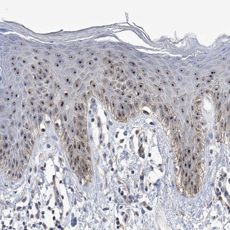 Immunohistochemistry (Formalin/PFA-fixed paraffin-embedded sections) - Anti-MPP10 antibody (AB204328), expandable thumbnail