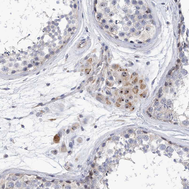 Immunohistochemistry (Formalin/PFA-fixed paraffin-embedded sections) - Anti-MPP10 antibody (AB204328), expandable thumbnail