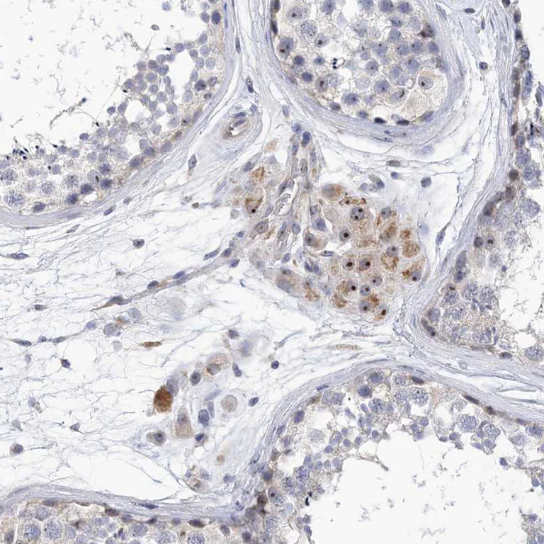 Immunohistochemistry (Formalin/PFA-fixed paraffin-embedded sections) - Anti-MPP10 antibody (AB204328)