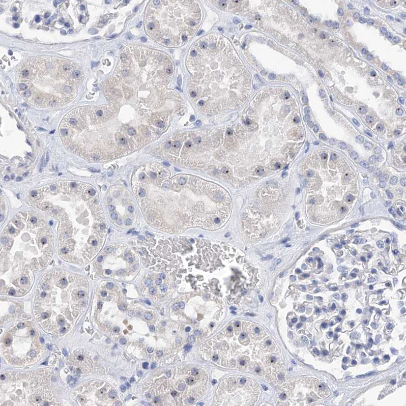 Immunohistochemistry (Formalin/PFA-fixed paraffin-embedded sections) - Anti-MPP10 antibody (AB204328), expandable thumbnail