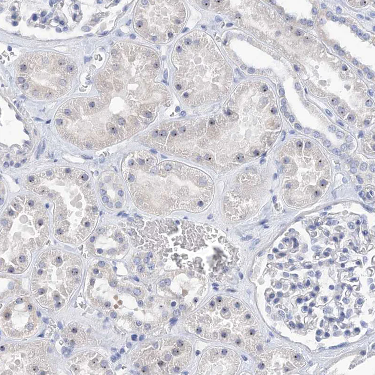 Immunohistochemistry (Formalin/PFA-fixed paraffin-embedded sections) - Anti-MPP10 antibody (AB204328)