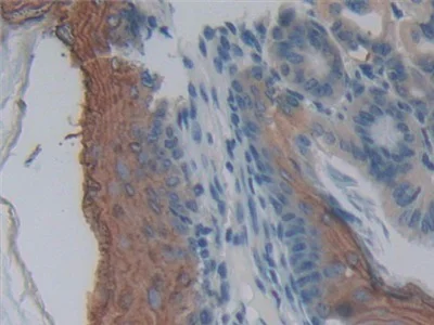Immunohistochemistry (Formalin/PFA-fixed paraffin-embedded sections) - Anti-MPP2/DLG2 antibody (AB231634)
