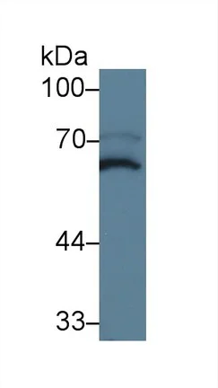 Western blot - Anti-MPP2/DLG2 antibody (AB231634)