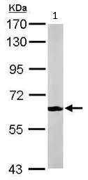 Western blot - Anti-MPP2/DLG2 antibody (AB97290)